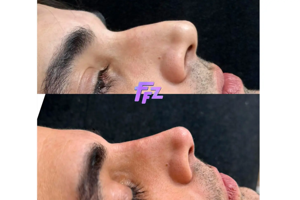 hgf