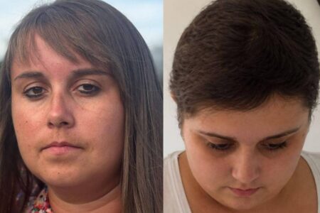 diagnóstico de câncer cerebral Mulher passa 11 anos em quimioterapia e descobre que nunca teve câncer Becky Jones