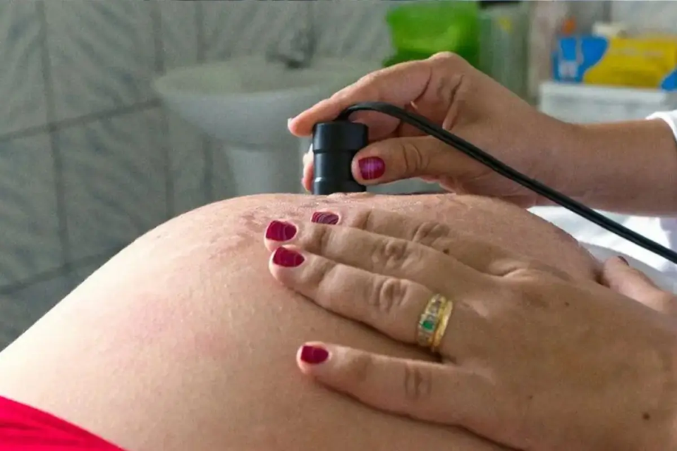 A taxa de detecção de sífilis em gestantes em Goiás subiu 57% entre 2021 e 2025, com 3.879 notificações no ano passado (Foto: Reprodução)