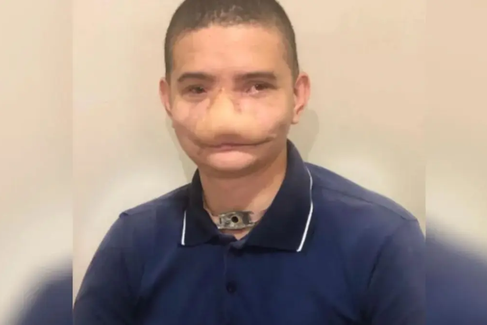 Samuel Rodrigues posa para foto após a recuperação do acidente