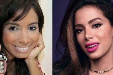 Anitta revela pressão por beleza na carreira: 'Eu era feia' Cantora diz que fez primeira cirurgia estética após ouvir que precisava se adequar