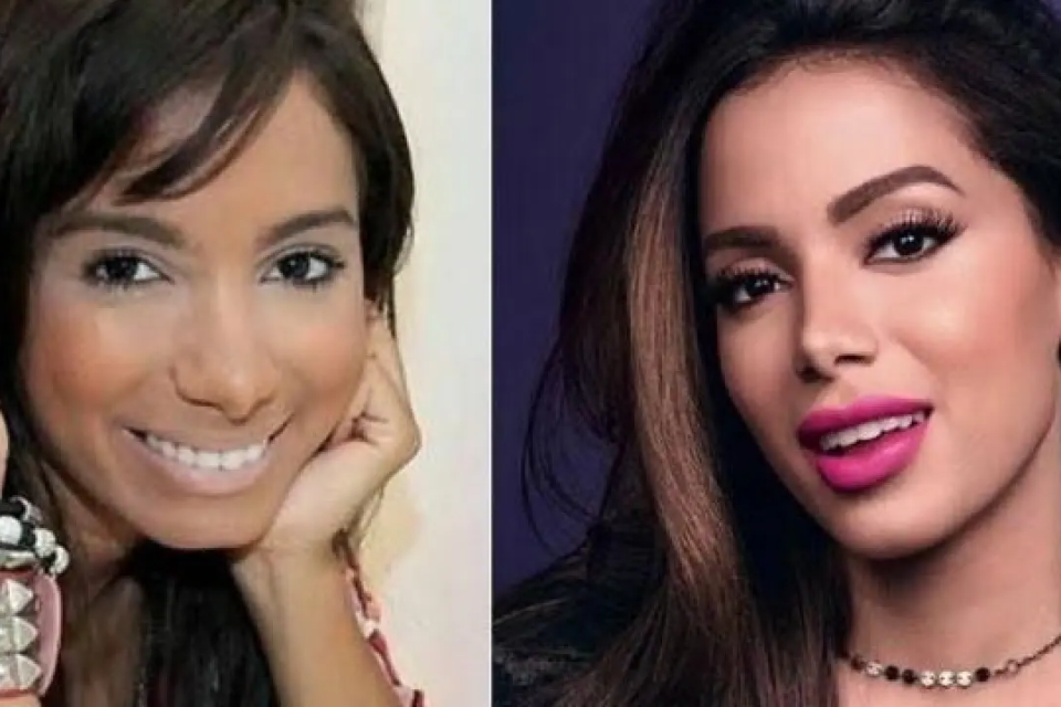 Anitta revela pressão por beleza na carreira: 'Eu era feia' Cantora diz que fez primeira cirurgia estética após ouvir que precisava se adequar